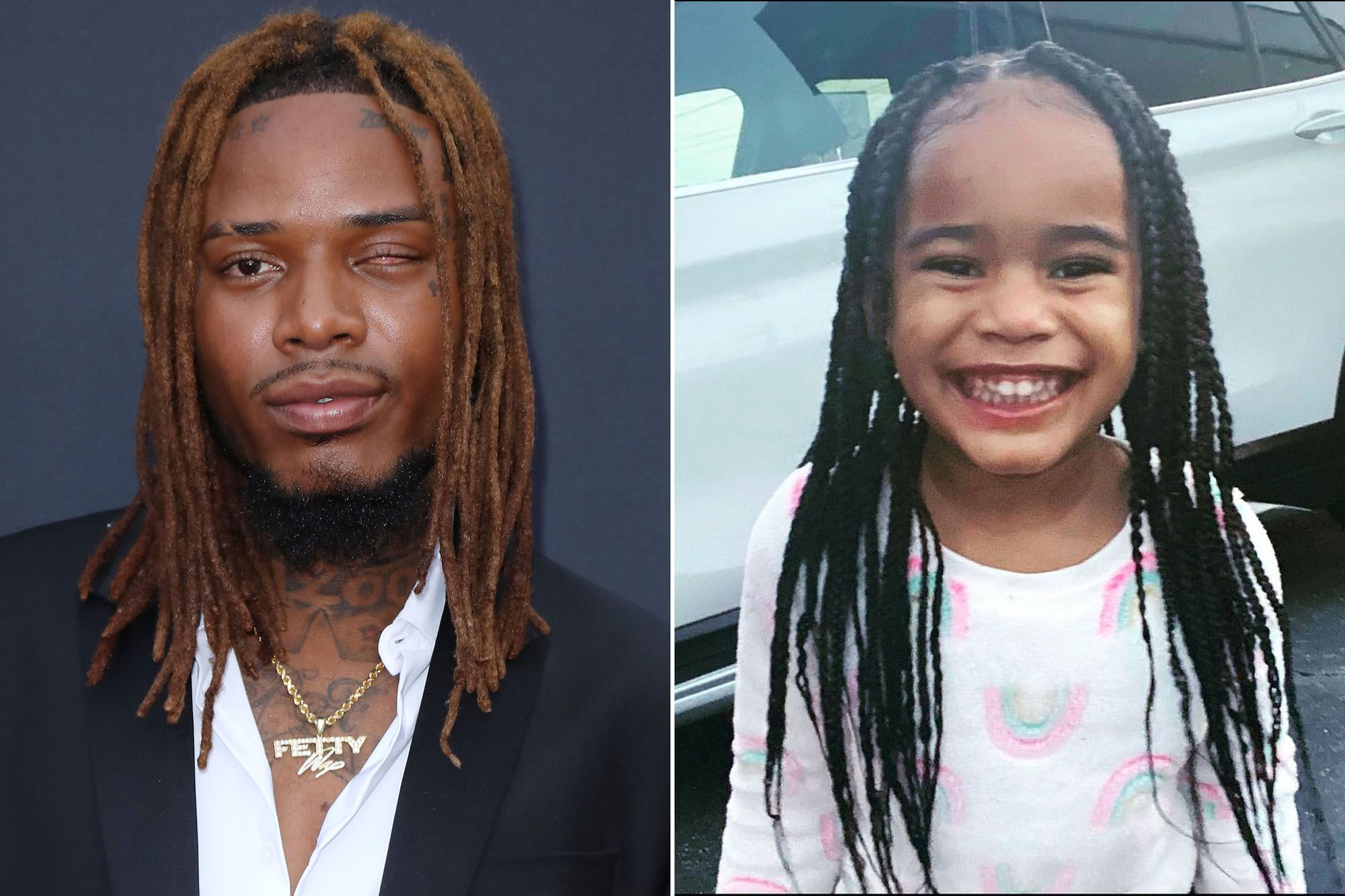 Fetty Wap’s Daughter Died of Heart Defect