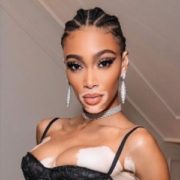 Winnie Harlow Shows Her Whole Body In New Pics Uploaded On Instagram